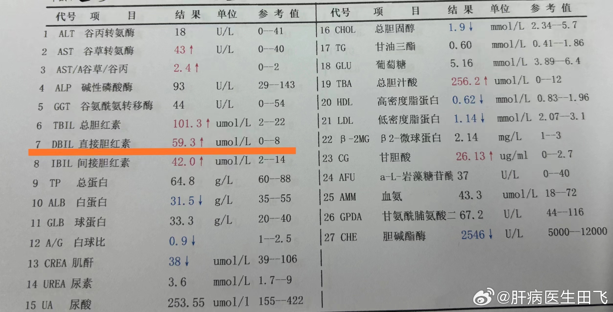 总胆红素与间接性升高—解读肝脏健康的隐形信号总胆红素和间接胆红素高说明什么问题 严重吗